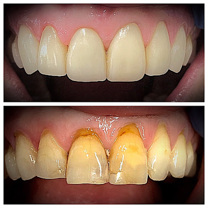 Implant Dentist of LA, Los Angeles