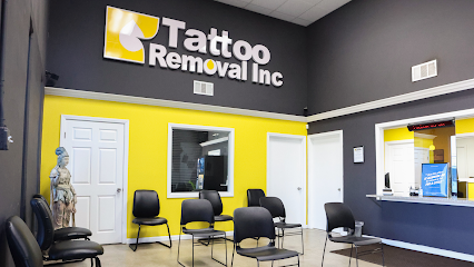 Tattoo Removal Inc
