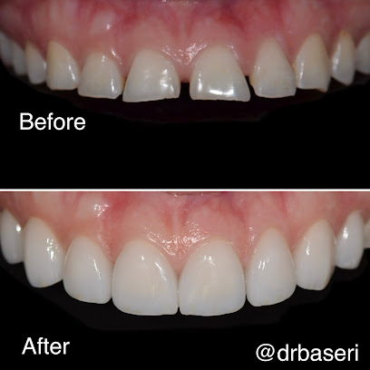 Smile Recreation Dentistry, Porcelain Veneers & Crowns, Invisalign, Implants, Oral Surgery & Gum Surgery, Emergency Dentist